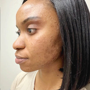 Reveal & Glow